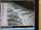 Ouchy2 001.jpg
