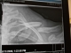 Ouchy2 003 (2).jpg