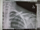 Ouchy2 005.jpg