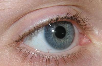 eye