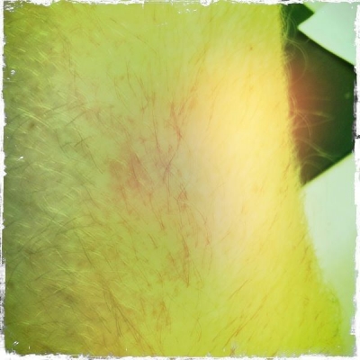 Marked Up Arm