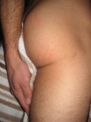 careful when scratching your ass