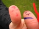 mortal wound