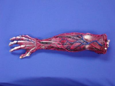 Arm