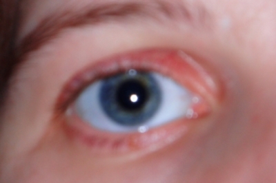 My eyes make me look tired today.