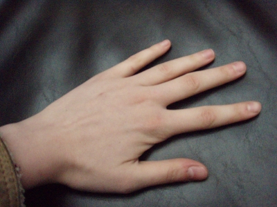 Hand