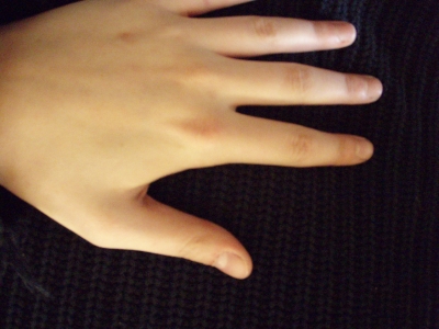 Hand