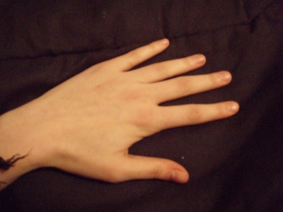 Hand
