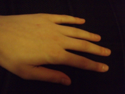 Hand