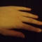 Hand