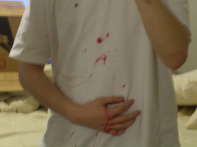 I cut my thumb.