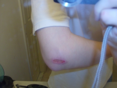 March 18 or 19 maybe...