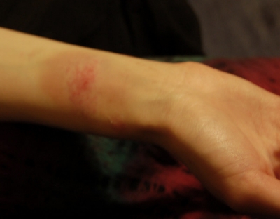 Day Two of the Rubberband Test