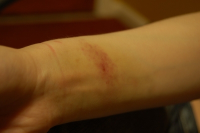 Rubberband Test Day 3