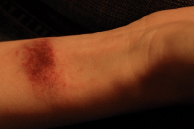 Day 1 for The Rubberband Test