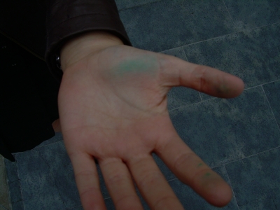 Evidence of Resistance