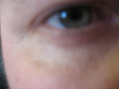 eye2.jpg