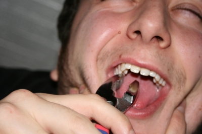 Go in for the teeth