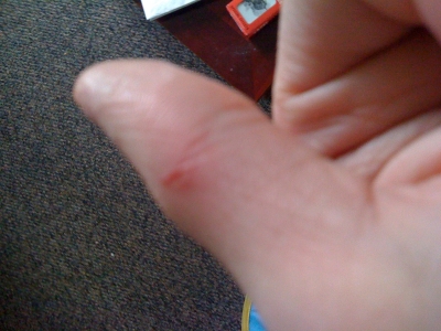 Left thumb