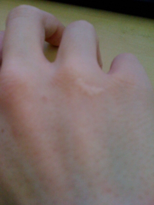 Right Knuckle