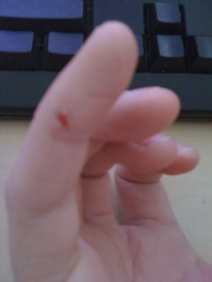 Right pinky
