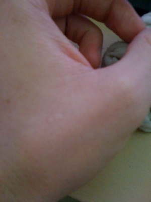 Left hand