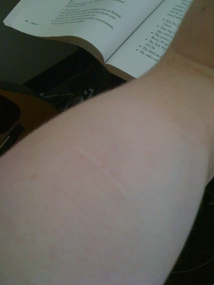 Left Bicep