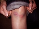 knee-day2.jpg