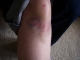 knee-day3.jpg
