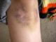 knee-day6.jpg