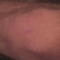 The Callouses on Your Hands by APR dreamlands The Callouses on Your Hands by APR dreamlands