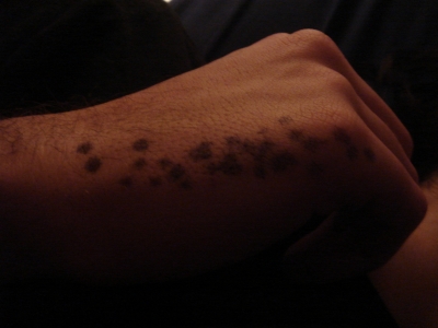 i perforated his hand