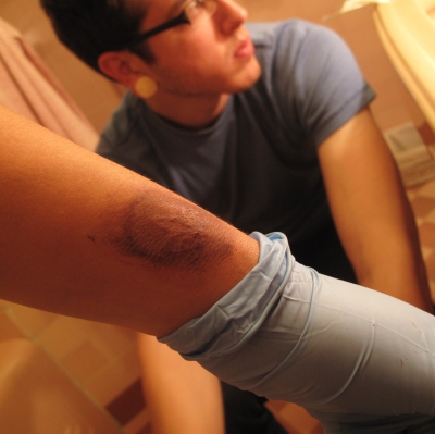 post-ash