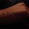 i perforated his hand