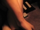 before: a round-shaped scar on left forearm