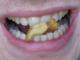 teeth.jpg