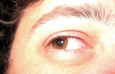 The right eye sees the world around him.