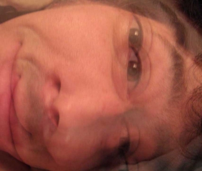 The curse of two-eyed attempts at intimacy.