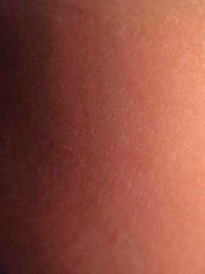 Skin texture.