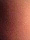 Skin texture.
