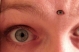 POVThirdEye.jpg