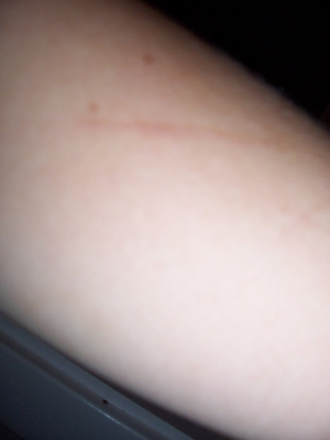 arm2.JPG