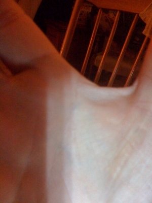 scar view 2