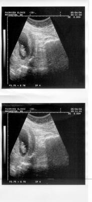 in utero