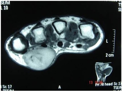 palm-fig1.jpg