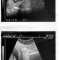 thumb brother in utero.jpg