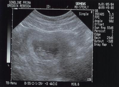 10 weeks