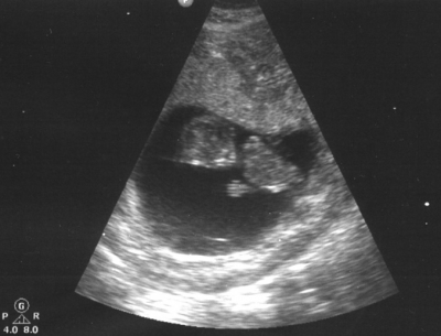 from the dark a benedictory, urgent prodding 