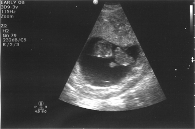 Second: meet Henry (due in June) Second: meet Henry (due in June)