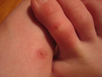 Toes